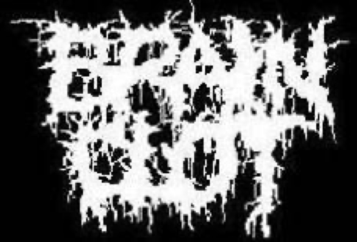 Brain Clot